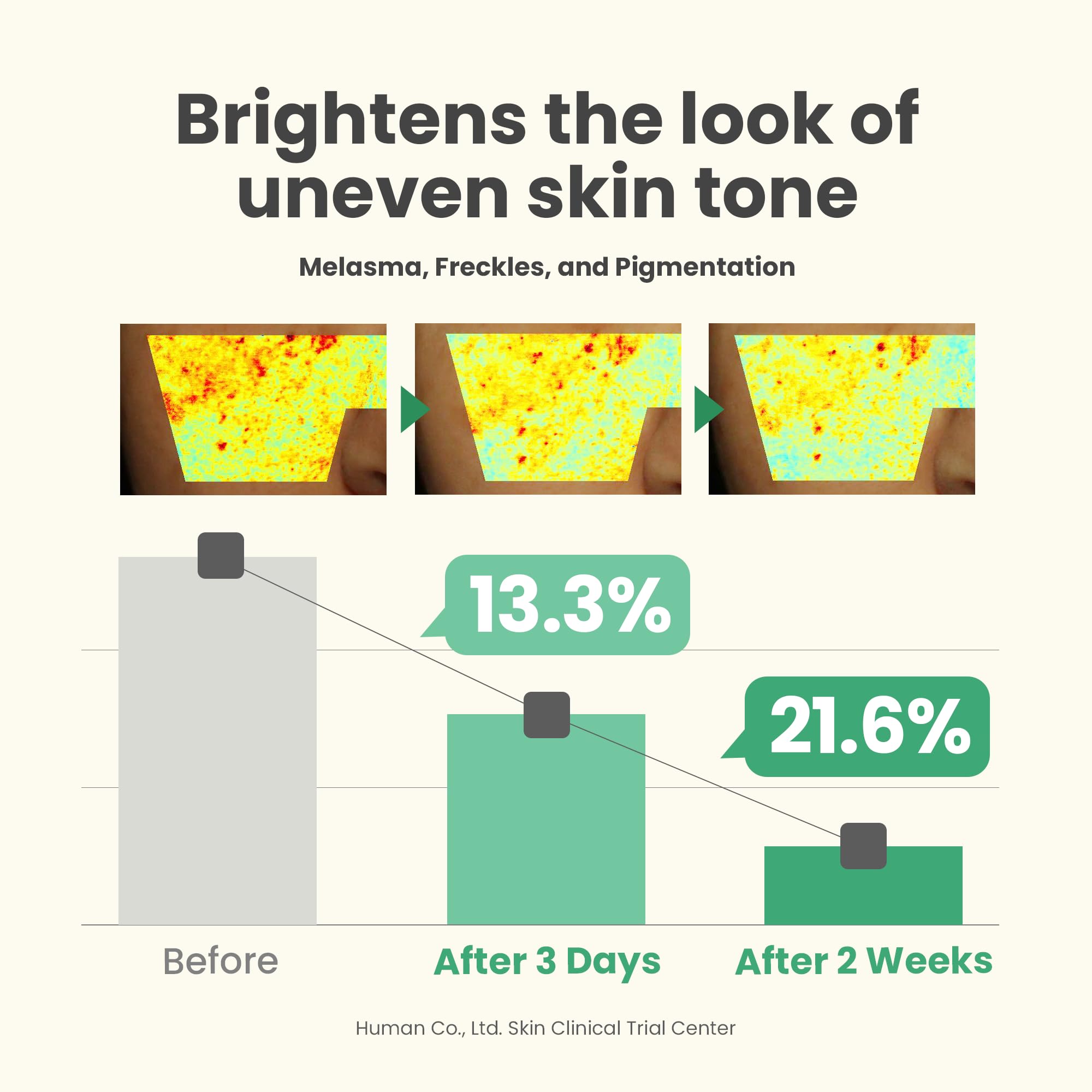 axis y dark spot correcting glow serum 5% niacinamide axis y dark spot correcting glow serum 5% niacinamide